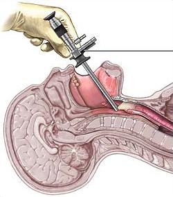 Ear , Nose and Throat Diseases and Surgery and Cochlear Implants