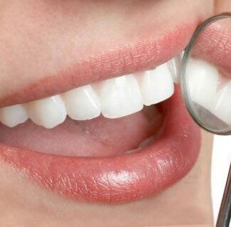 Dental Implants and Cosmetic