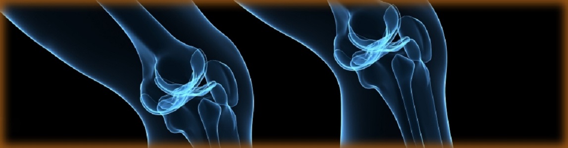 Arthritis and Rheumatic Diseases