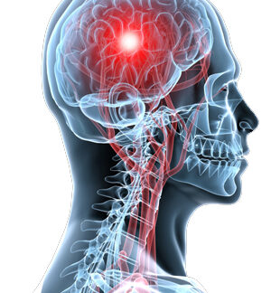 Brain and Nerves and Spine Surgery